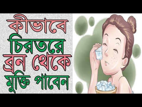 কিভাবে চিরতরে ব্রন থেকে মুক্তি পাবেন || How To Remove Pimple || Acne Treatment || Beauty Tips Video