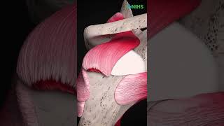 Comprehensive Orthopedic Care At Nihs