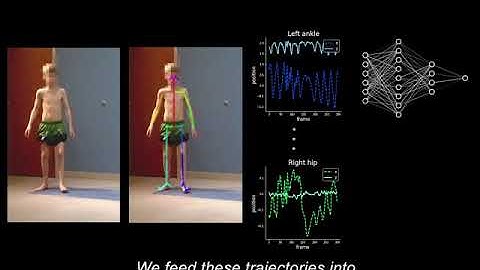 2D Video-Analysis Technology to Analyze Gait