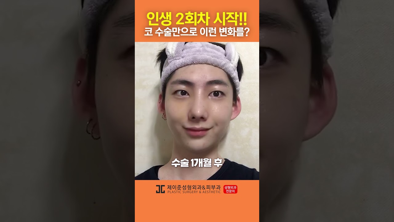 [Thẩm mỹ viện da liễu Jayjun] Chỉ phẫu thuật mũi mà cứ như thành người khác vậy! #shorts