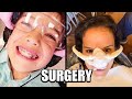 WHICH IS WORSE!? wisdom teeth REMOVAL or Braces!?