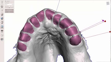 Meshmixer: Virtual Full Arch Extraction