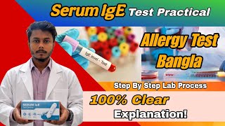 Serum IgE Test Practical Step By Step Bangla | Allergy Test Lab Procedure | Rasel Ahmed Lab
