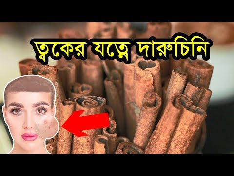 ত্বকের যত্নে দারুচিনি  Cinnamon In Skin Care  Health Care SHR