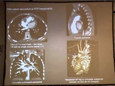 Video: Malformații Ale Valvei Cardiace La Pisici