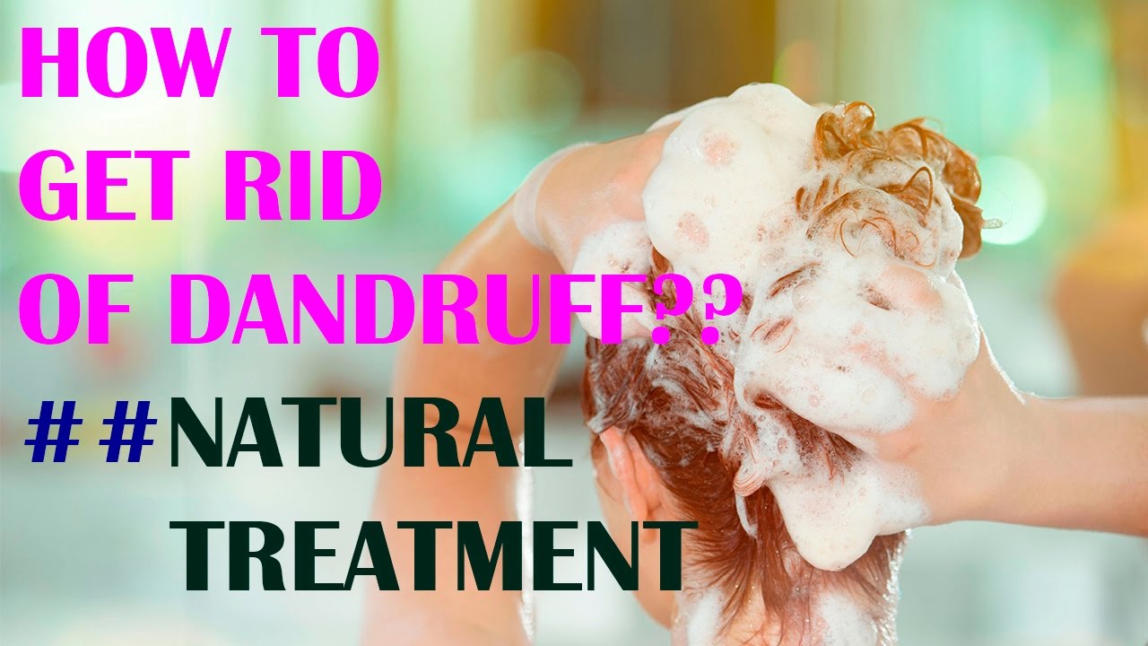 How To get Rid Of Dandruff ? Natural Treatment Home Remedies By