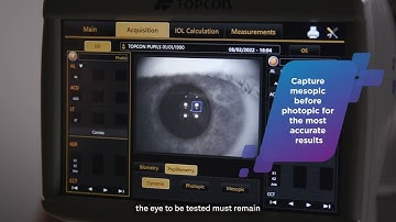 How to Capture Pupillometry Data on my Topcon Aladdin