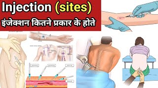 Injection | Route of Injection | Types of Injection | Injection kaise lgate hai | Nursing | medical 
