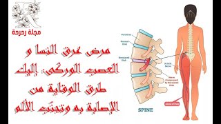 مرض عرق النسا و العصب الوركى: إليك طرق الوقاية من الإصابة به وتجنّب الألم