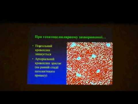 Ультразвукове дослідження при портальній гіпертензії