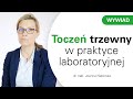 Ciekawe przypadki diagnostyczne: toczeń trzewny w praktyce laboratoryjnej [HD]