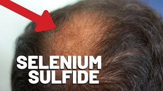 Selenium Benefits for Hair How to Get Soft Shiny Healthy Hair  Noophoric