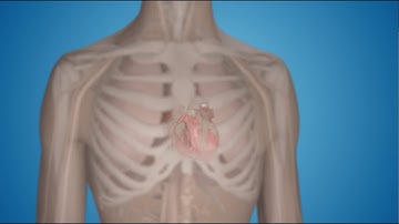 What Is a Pacemaker and How Does It Work?