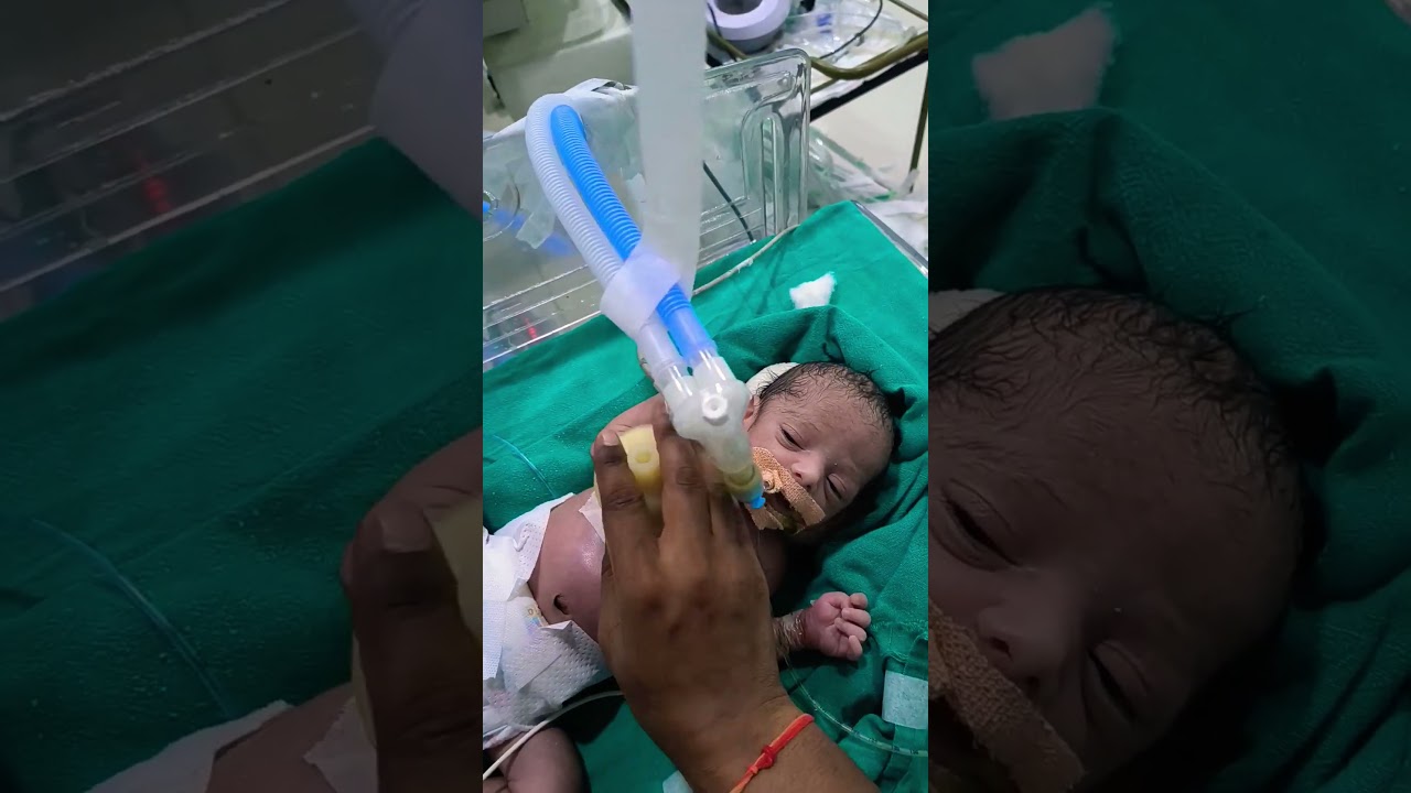 chest physiotherapy newborn baby 