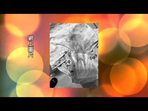 三歲女兒下體出血惹虐待疑雲翻查閉路電視後真相原來係咁？