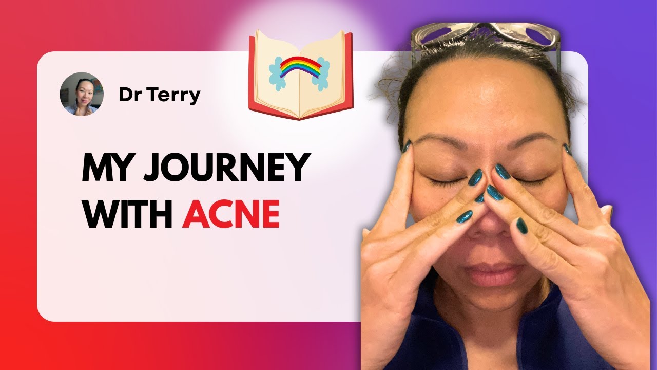 My Honest Acne Journey: From Teen Years to Perimenopause