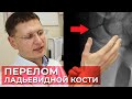 Как лечить, выявить перелом ладьевидной кости? Самая сложная кость в лечении