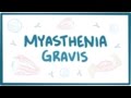 Myasthenia gravis - causes, symptoms, treatment, pathology
