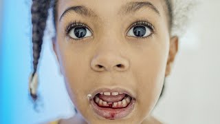 Tooth falls out, twin sister concerned