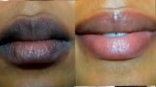 Download lagu Hidhiin Keessan Akka Hin Babbaqaqneefi Akka Hin Goggogne Gochuuf Karqq Salphaa Ta'een Kan Gurraachay