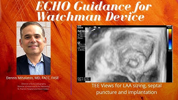 ECHO Guidance for Watchman Device- TEE Views for LAA sizing, Trans-septal Puncture and Implantation