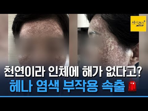 천연이라던 <strong>헤나</strong> 왜?_191202(월)