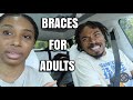 Victoria&#39;s brother gets Braces: Come with us to get Adult Braces