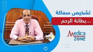 تشخيص وعلاج سماكة بطانة الرحم | الدكتور اسماعيل مصطفى | MedicaZone