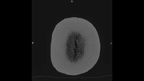 CT scan of a pumpkin. 600 microns. Sagittal reconstructions.