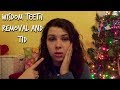 Wisdom Teeth Removal and Type One Diabetes! |T1 TUESDAY|