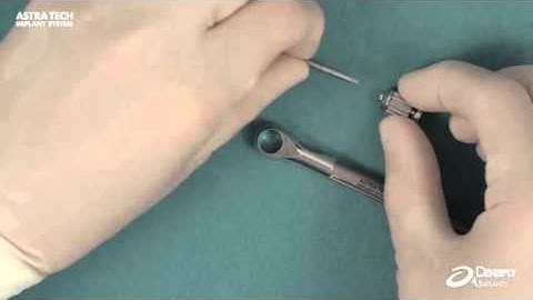 Atlantis™ abutments – Placement and tightening | Dentsply Sirona