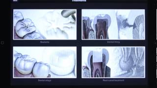 DENTPAD: TREATMENT TUTORIAL screenshot 5