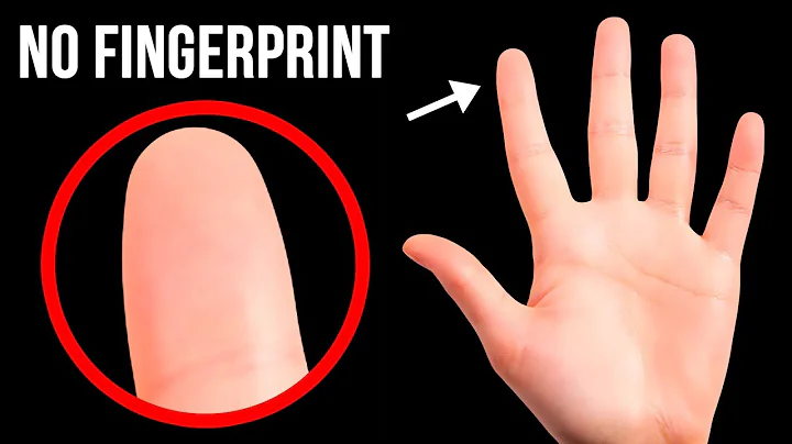 What If You Had No Fingerprints - DayDayNews