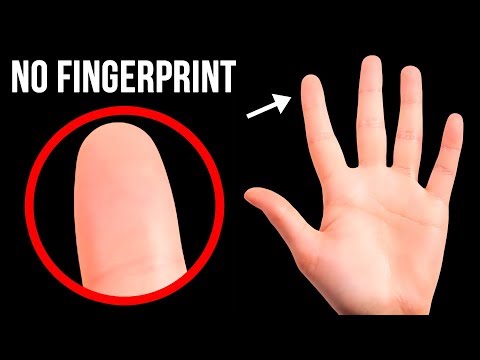 Video: People Without Fingerprints - Alternative View