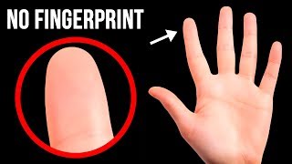 What If You Had No Fingerprints