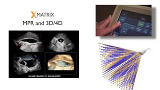 Iu22 Xmatrix Ultrasound System