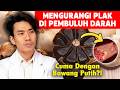 Cara Bersihkan Plak Pembuluh Darah! TERNYATA Bisa Dengan Cara INI