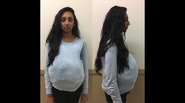 Metabical Commercial