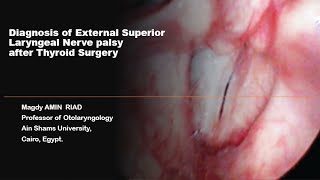 Diagnosis of External Superior Laryngeal Nerve palsy after Thyroid Surgery screenshot 2