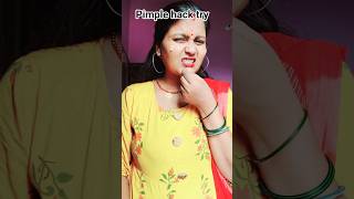 Diy pimple hack✅️#diy #ashortaday #hack #pimple #youtubeshorts #shorts #trending