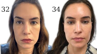 I spent $30,000 on antiaging treatments  What's worth it?