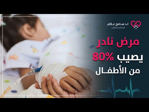 مرض نادر 80% من المصابين أطفال - اعراض مرض كاواساكي وعلاجه | دكتور سامح علام