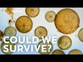 What If All the Microbes Disappeared?