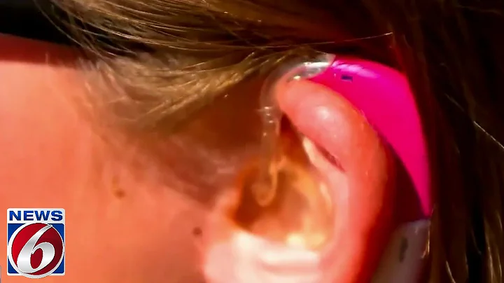 Over-the-counter hearing aids could be right for you