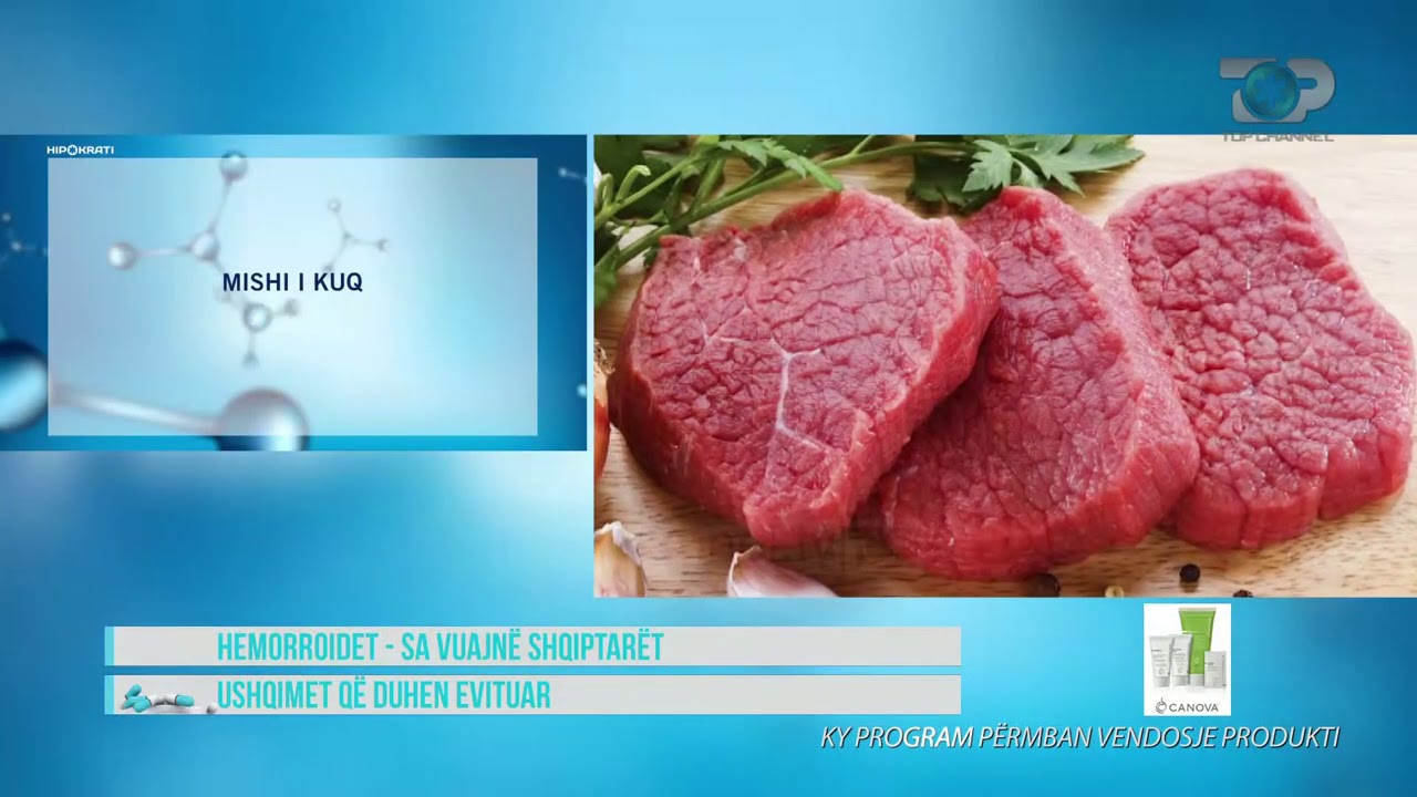 Hipokrati - Hemorroidet - Ushqimet e ndaluara  dhe të lejuara - 30 Janar 2021