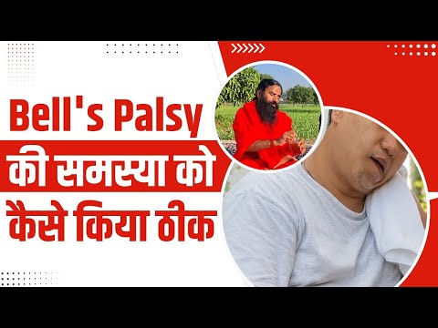 Bell's Palsy की समस्या को कैसे किया ठीक || Swami Ramdev