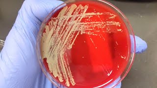 Microbiology Culture Techniques -- Culturing Microorganisms