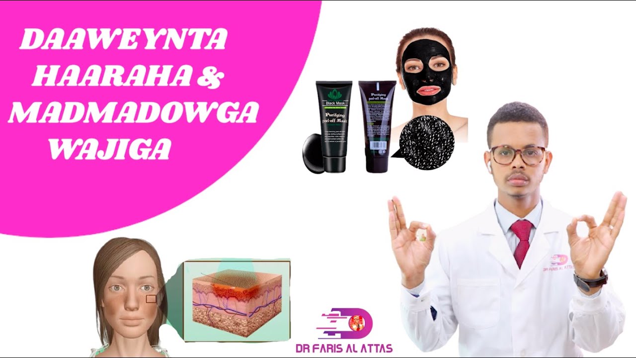 DAAWEYNTA HAARAHA IYO BARAHA MADMADOW EE WAJIGA. Dr faris