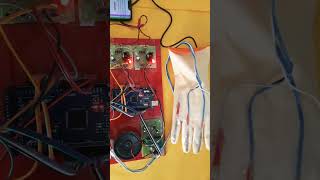 Enhancing patient health monitoring system IOT Sensor&#39;s #school #science #short