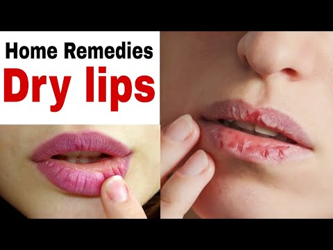 Home Remedy For Dry Lips |Best Home Remedies To Get Rid of Chapped lips | Home Remedies with Mahbuba